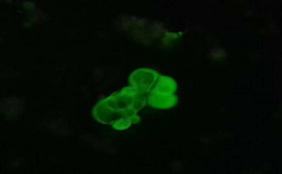 Осадок асцитической жидкости, ФИЦХ (СА125), AlexaFluor-488