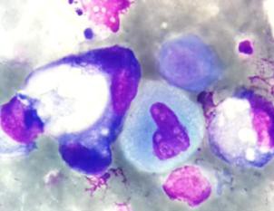 Приготовление цитологических препаратов, проведение дополнительных исследований (ИЦХ, ФИЦХ, ПЦР, NGS, cell-block).