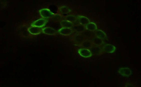 Интраоперационный соскоб с легкого, 5 день в ТПС-1, ФИЦХ (EpCAM/BerEP4), AlexaFluor-488
