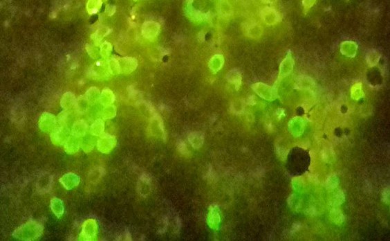 Интраоперационный соскоб с легкого, 5 день в ТПС-1, ФИЦХ (СК7), AlexaFluor-488