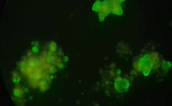 Осадок асцитической жидкости, ФИЦХ (EpCAM/BerEP4), AlexaFluor-488